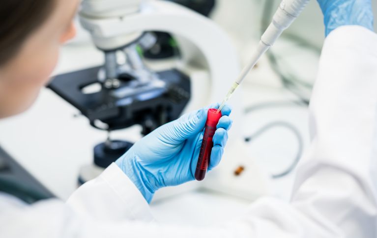 Laboratory worker checks the blood in the laboratory.