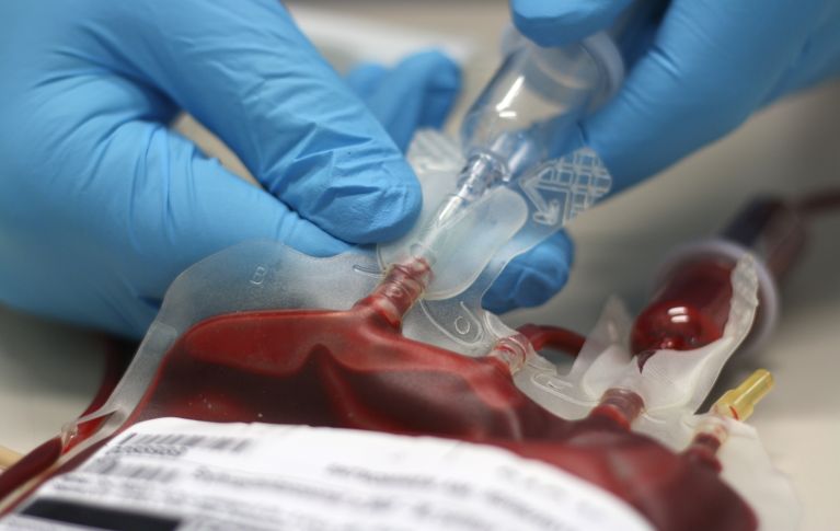 Arzt zieht das Blut aus einer Blutkonserve raus