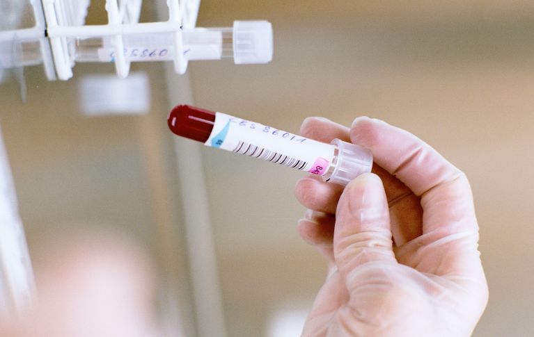 The picture shows a blood sample in the laboratory in a labelled tube held by a person. 